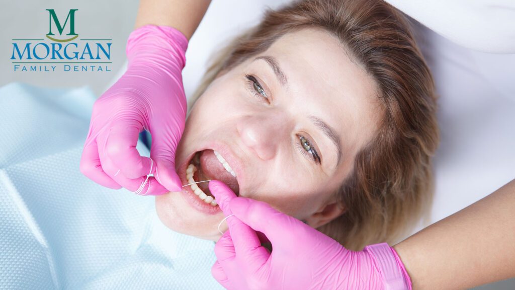 Teeth Cleaning at Metairie Dentist