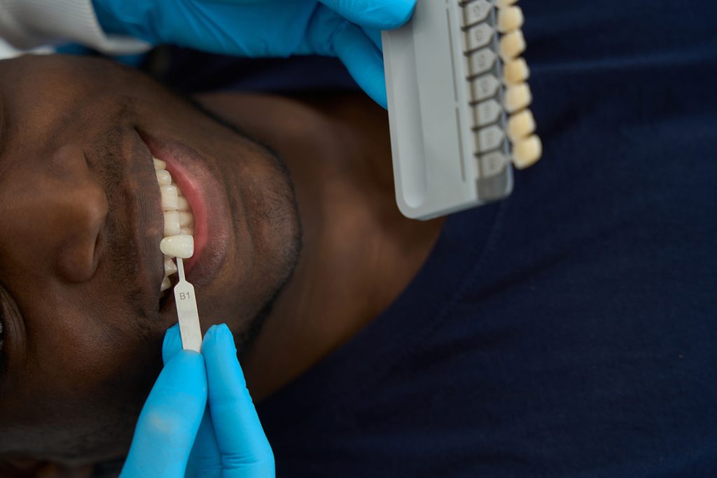 Dental Veneers in Metairie - Dr. Ken Morgan's Expertise