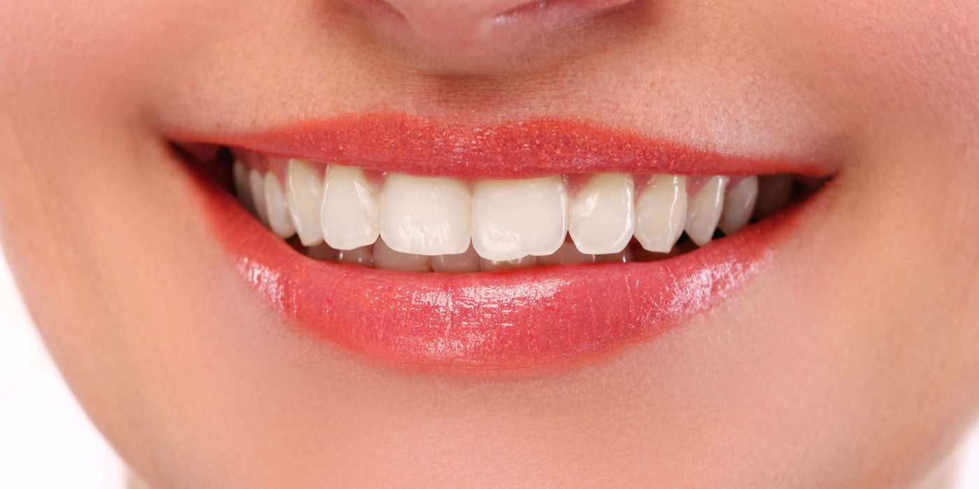 Professional Teeth Whitening Services in Metairie