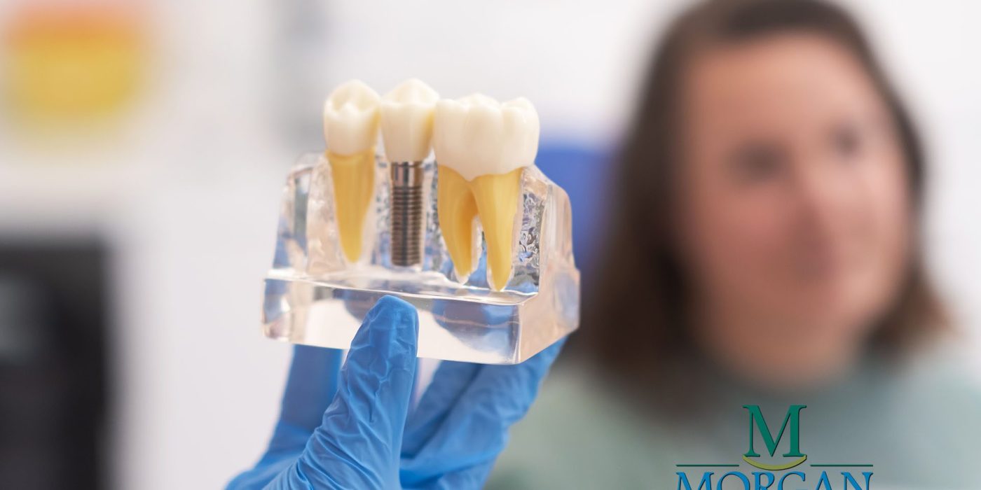 Implant Restore Your Smile Permanently with Dental Implants