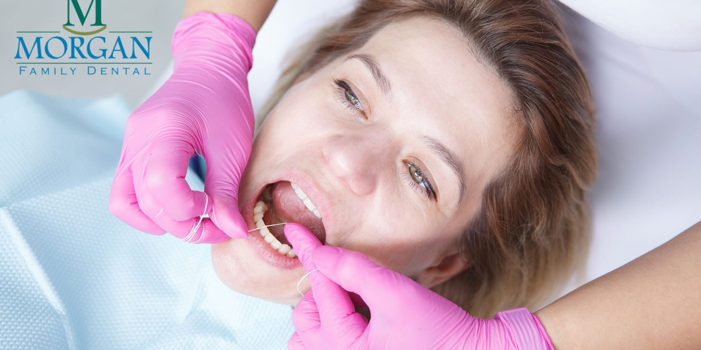 Teeth Cleaning at Metairie Dentist